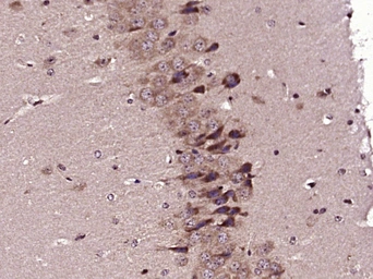 Anti-SPON1 antibody used in IHC (Paraffin sections) (IHC-P). GTX51796