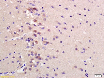 Anti-CCDC61 antibody used in IHC (Paraffin sections) (IHC-P). GTX51908