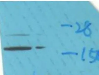 Anti-Calmodulin (phospho Thr79/Ser81) antibody used in Western Blot (WB). GTX52331