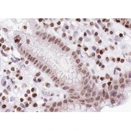 Anti-FOXO1 (phosphoThr24) + FOXO3a (phospho Thr32) + FOXO4 (phospho Thr28) antibody used in IHC (Paraffin sections) (IHC-P). GTX52338