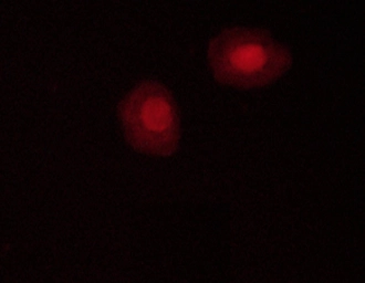 Anti-AMPK alpha 1 (phospho Thr183) + AMPK alpha 2 (phospho Thr172) antibody used in Immunocytochemistry/ Immunofluorescence (ICC/IF). GTX52341