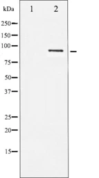 Anti-STAT5B antibody used in Western Blot (WB). GTX52362