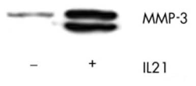 Anti-MMP3 antibody [3E44] used in Western Blot (WB). GTX52474