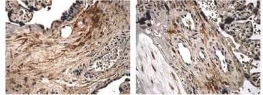 Anti-BMPR1A antibody [8L7] used in IHC (Paraffin sections) (IHC-P). GTX52504