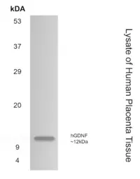 Anti-GDNF antibody [12F9] used in Western Blot (WB). GTX52761