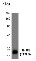 Anti-IL1F8 antibody [2Q27] used in Western Blot (WB). GTX52841
