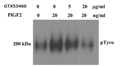 Anti-PLGF antibody [9G33] used in Neutralizing/Blocking/Inhibition (Neutralizing /Inhibition). GTX53460