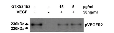 Anti-VEGF Receptor 2 antibody [MAB0701] used in Neutralizing/Blocking/Inhibition (Neutralizing /Inhibition). GTX53463