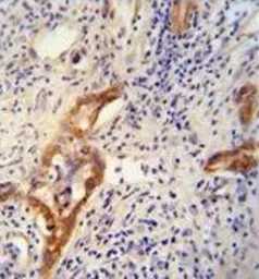 Anti-CLPX antibody used in IHC (Paraffin sections) (IHC-P). GTX53477