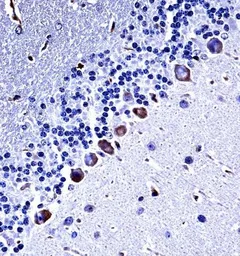 Anti-Casein Kinase I gamma 3 antibody used in IHC (Paraffin sections) (IHC-P). GTX53489