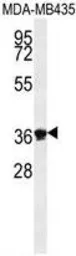 Anti-Exonuclease 5 antibody used in Western Blot (WB). GTX53538