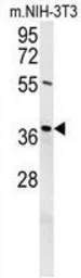 Anti-Exonuclease 5 antibody used in Western Blot (WB). GTX53538