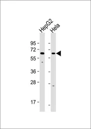 Anti-EHD1 antibody used in Western Blot (WB). GTX53560