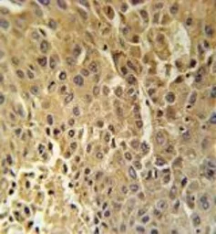 Anti-HSD17B13 antibody used in IHC (Paraffin sections) (IHC-P). GTX53602