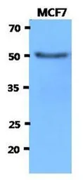 Anti-HEXA antibody [AT20F1] used in Western Blot (WB). GTX53726