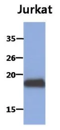 Anti-MAFK antibody [AT2F7] used in Western Blot (WB). GTX53738