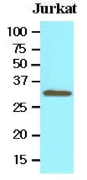 Anti-Tollip antibody [k1B17] used in Western Blot (WB). GTX53793