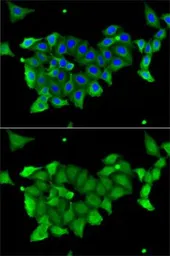 Anti-Carbonic Anhydrase 1 antibody used in Immunocytochemistry/ Immunofluorescence (ICC/IF). GTX53905