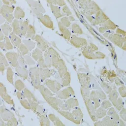 Anti-Carbonic Anhydrase III antibody used in IHC (Paraffin sections) (IHC-P). GTX53907