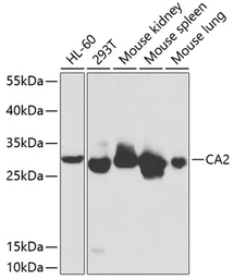 Anti-Carbonic Anhydrase II antibody used in Western Blot (WB). GTX53908