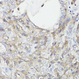 Anti-CD59 antibody used in IHC (Paraffin sections) (IHC-P). GTX53909