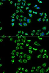 Anti-CD1d antibody used in Immunocytochemistry/ Immunofluorescence (ICC/IF). GTX53911