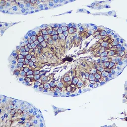 Anti-CD47 antibody used in IHC (Paraffin sections) (IHC-P). GTX53912
