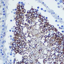 Anti-CD47 antibody used in IHC (Paraffin sections) (IHC-P). GTX53912