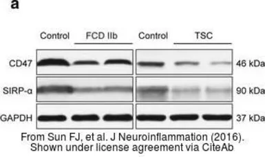 Anti-CD47 antibody used in Western Blot (WB). GTX53912