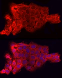 Anti-CD47 antibody used in Immunocytochemistry/ Immunofluorescence (ICC/IF). GTX53912