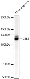 Anti-Cbl-b antibody used in Western Blot (WB). GTX53915
