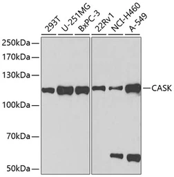 Anti-CASK antibody used in Western Blot (WB). GTX53920