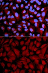Anti-CASK antibody used in Immunocytochemistry/ Immunofluorescence (ICC/IF). GTX53920