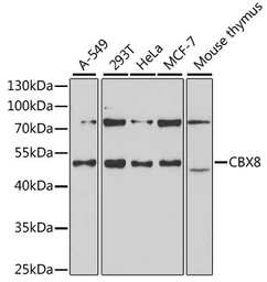 Anti-CBX8 antibody used in Western Blot (WB). GTX53929