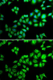 Anti-Cullin 1 antibody used in Immunocytochemistry/ Immunofluorescence (ICC/IF). GTX53945