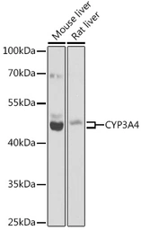 Anti-CYP3A4 antibody used in Western Blot (WB). GTX53947
