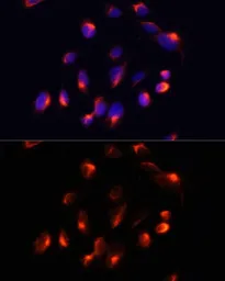 Anti-CYP3A4 antibody used in Immunocytochemistry/ Immunofluorescence (ICC/IF). GTX53947