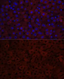 Anti-CYP3A4 antibody used in IHC (Paraffin sections) (IHC-P). GTX53947