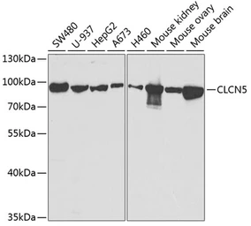 Anti-CLCN5 antibody used in Western Blot (WB). GTX53963