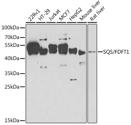 Anti-FDFT1 antibody used in Western Blot (WB). GTX53976