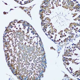 Anti-FDFT1 antibody used in IHC (Paraffin sections) (IHC-P). GTX53976