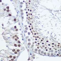 Anti-FANCC antibody used in IHC (Paraffin sections) (IHC-P). GTX53977