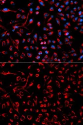 Anti-DOK4 antibody used in Immunocytochemistry/ Immunofluorescence (ICC/IF). GTX53984