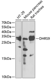 Anti-DHRS9 antibody used in Western Blot (WB). GTX54001
