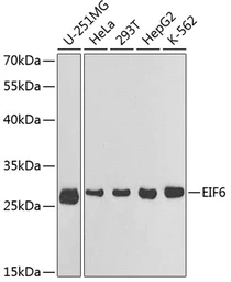Anti-EIF6 antibody used in Western Blot (WB). GTX54010
