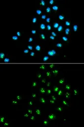 Anti-EIF6 antibody used in Immunocytochemistry/ Immunofluorescence (ICC/IF). GTX54010