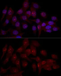 Anti-EIF6 antibody used in Immunocytochemistry/ Immunofluorescence (ICC/IF). GTX54010
