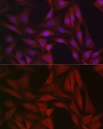 Anti-Ferritin Heavy Chain antibody used in Immunocytochemistry/ Immunofluorescence (ICC/IF). GTX54014