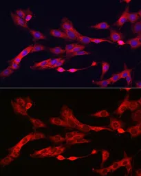 Anti-Ferritin Heavy Chain antibody used in Immunocytochemistry/ Immunofluorescence (ICC/IF). GTX54014