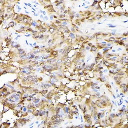 Anti-Ferritin Heavy Chain antibody used in IHC (Paraffin sections) (IHC-P). GTX54014
